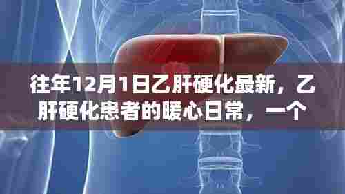 乙肝硬化患者的暖心日常，温馨故事与最新资讯记录