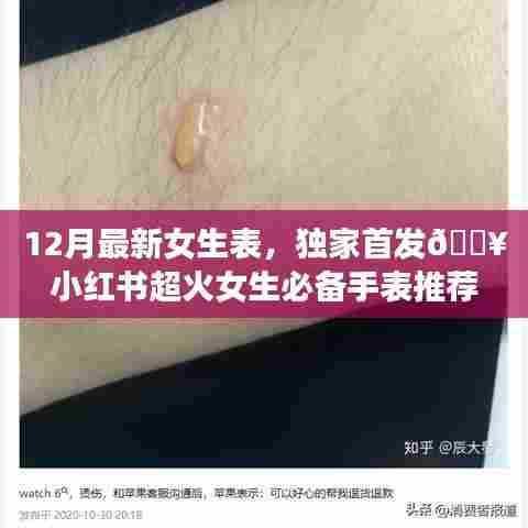 十二月女生手表独家推荐，小红书超火必备款，引领时尚潮流风向标！