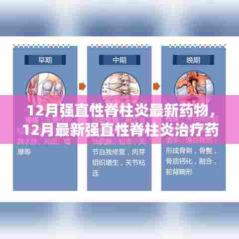 12月强直性脊柱炎最新治疗药物进展概览