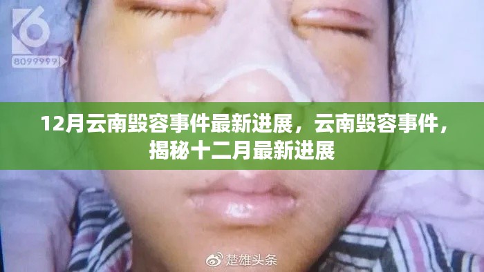 揭秘云南毁容事件最新进展,十二月更新动态