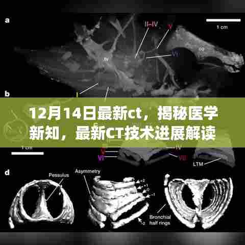 最新CT技术进展解读，医学新知揭秘（12月14日更新版）