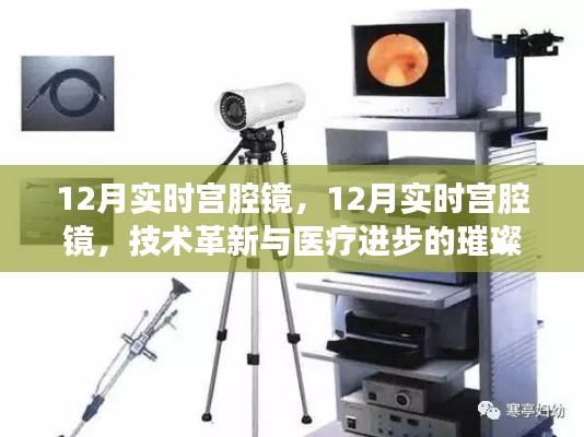 12月实时宫腔镜技术革新,医疗进步的璀璨篇章