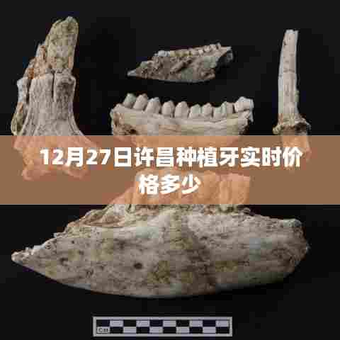 许昌种植牙最新实时价格公布