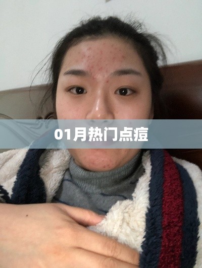 最新热门点痘榜单来袭