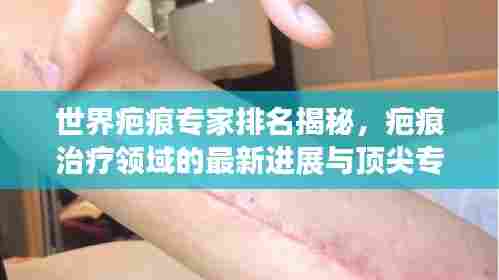 世界疤痕专家排名揭秘,疤痕治疗领域的最新进展与顶尖专家解读