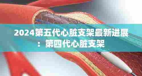 2024第五代心脏支架最新进展:第四代心脏支架