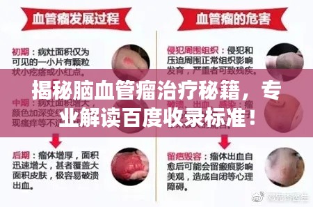 揭秘脑血管瘤治疗秘籍，专业解读百度收录标准！