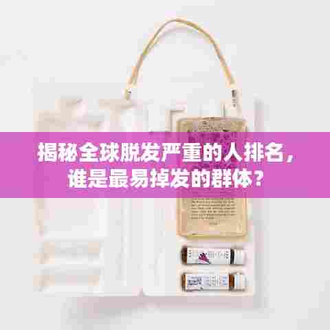 揭秘全球脱发严重的人排名，谁是最易掉发的群体？