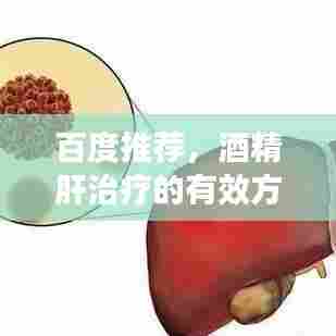 百度推荐，酒精肝治疗的有效方法，健康从此开始！