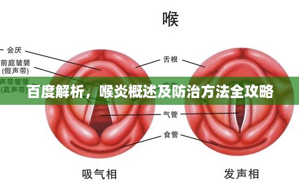 百度解析,喉炎概述及防治方法全攻略