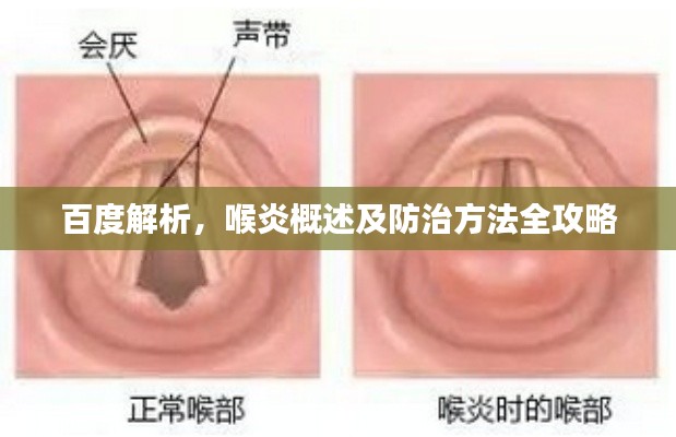 百度解析,喉炎概述及防治方法全攻略