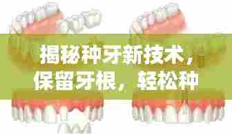 揭秘种牙新技术,保留牙根,轻松种牙!